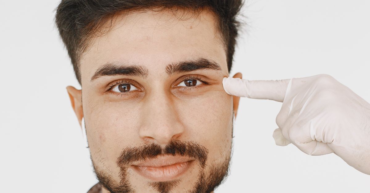 Blefaroplastia Hombre