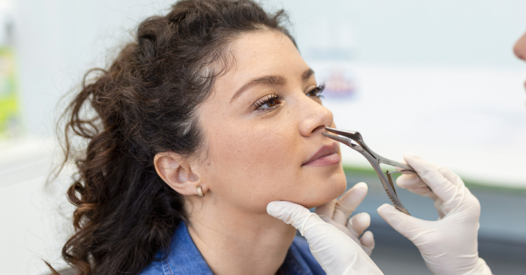 rinoplastia 2