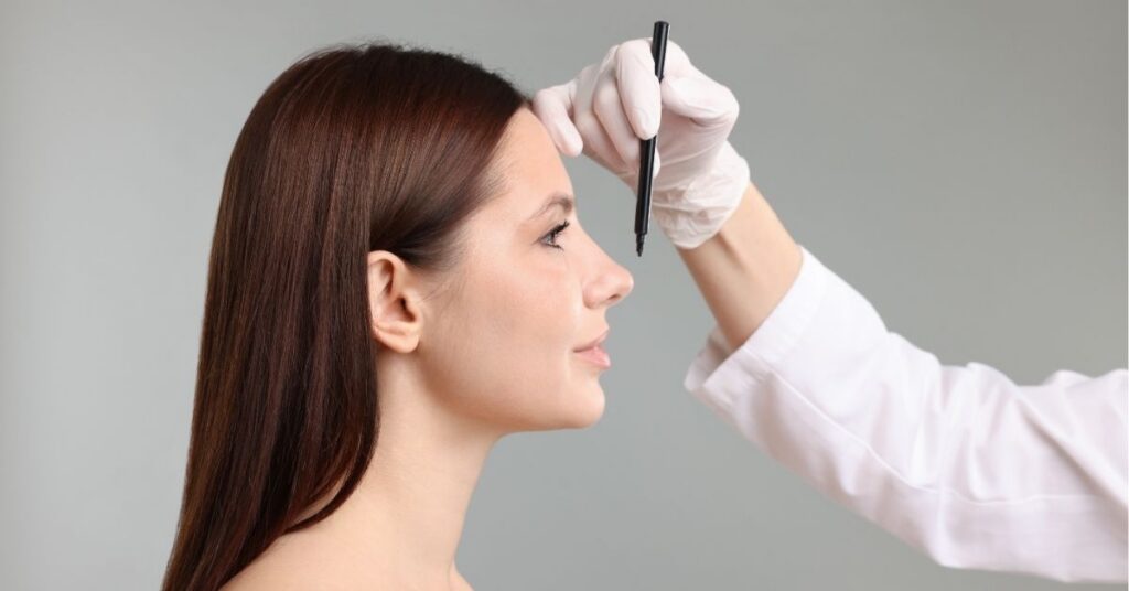 resultados naturales rinoplastiia dr jaime