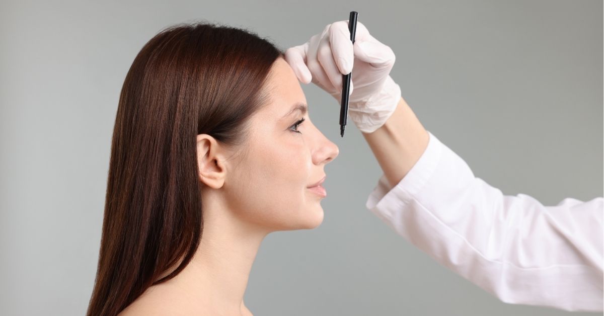 resultados naturales rinoplastiia dr jaime